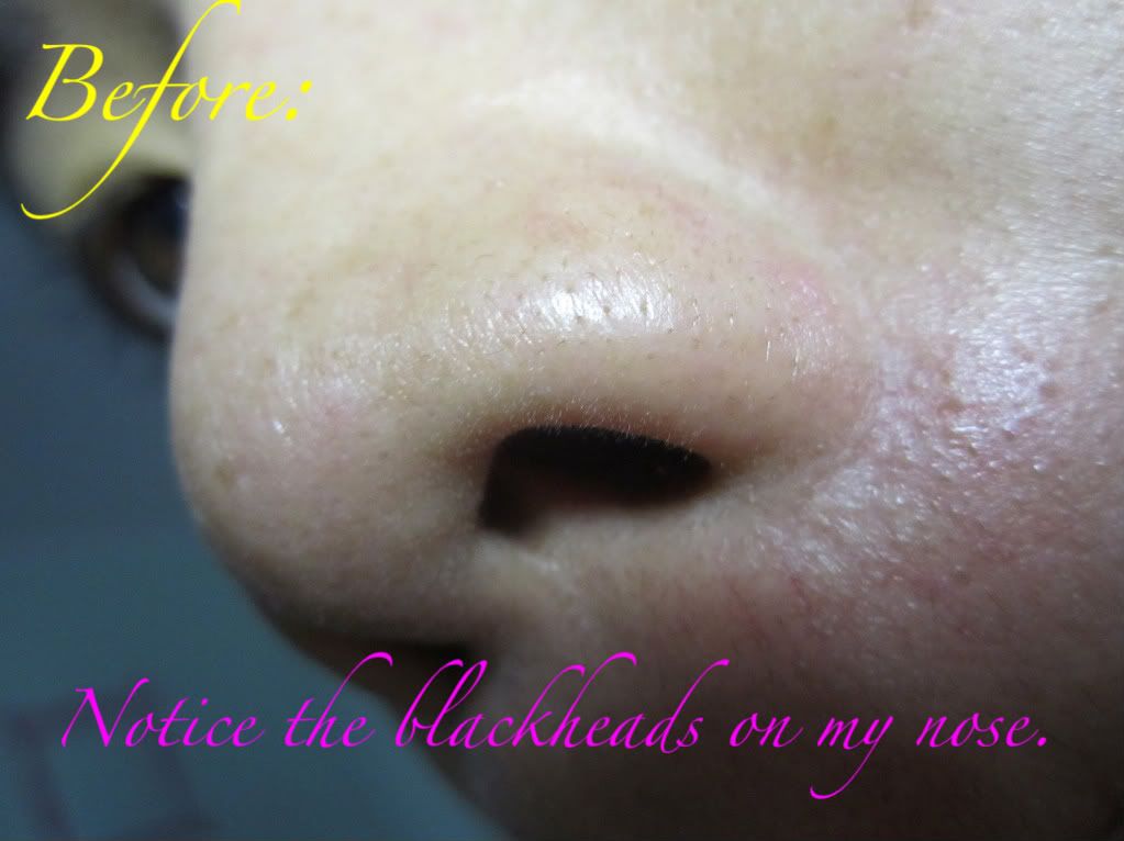 clogged pores on nose. of my clogged pores zoomed